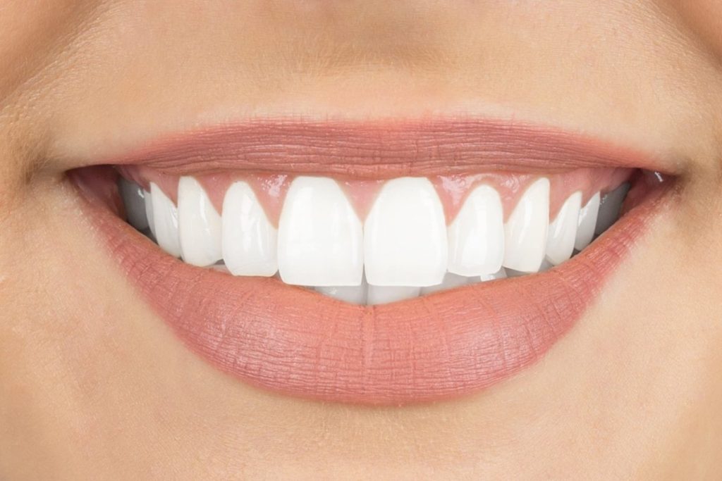 San Marcos Dental Implants
