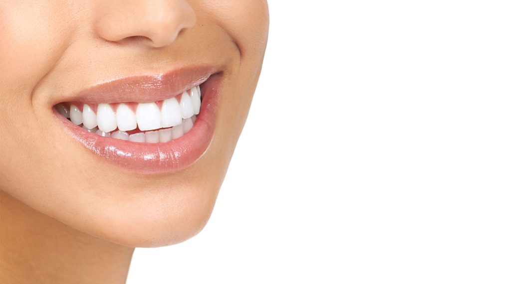 Oceanside Dental Veneers
